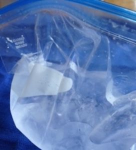 Ice bag with water to ease pain
